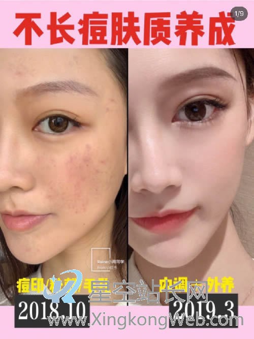 如何运营小红书？小红书完整推广运营方案